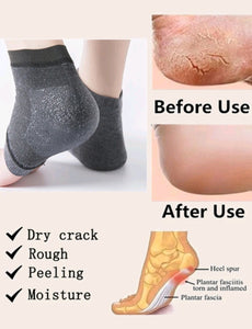 Silicone Anti-Crack Heel Socks • 1 Pair